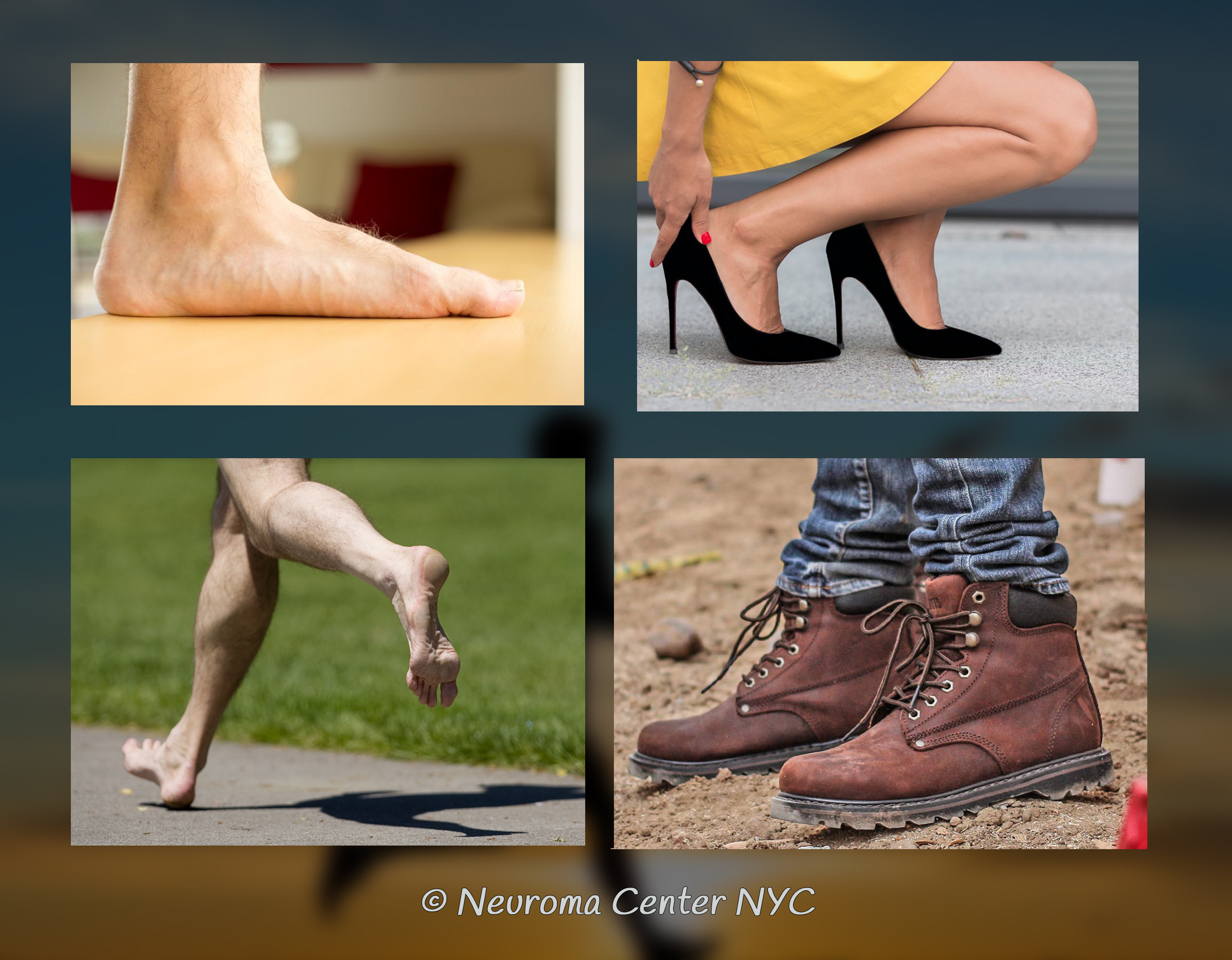 What causes neuromas p01